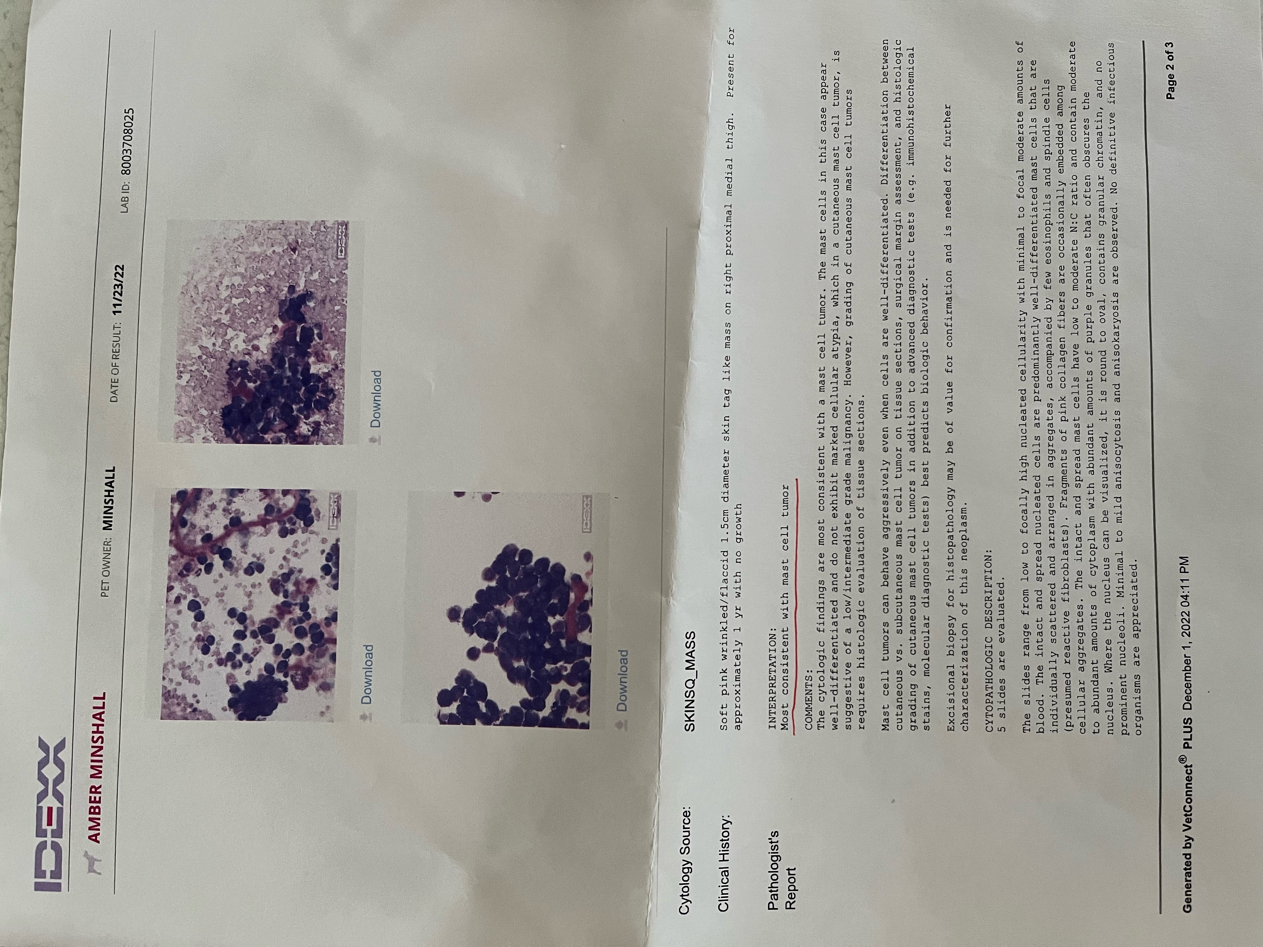tumor diagnosis 2022